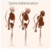 estrogen spine