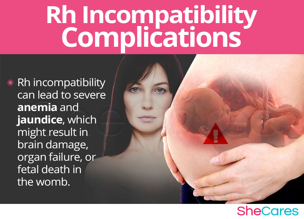 Rh Incompatibility Complications