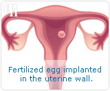 Fertilized egg implanted in the uterine wall.
