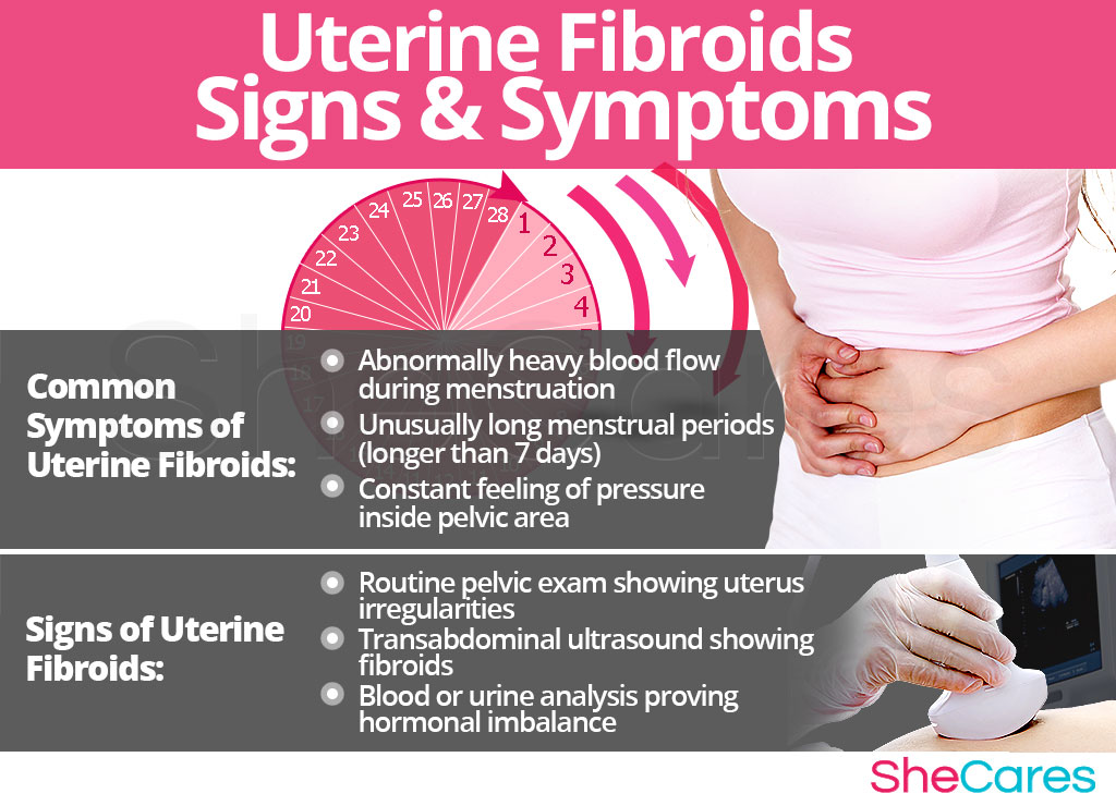 Uterine fibroids symptoms