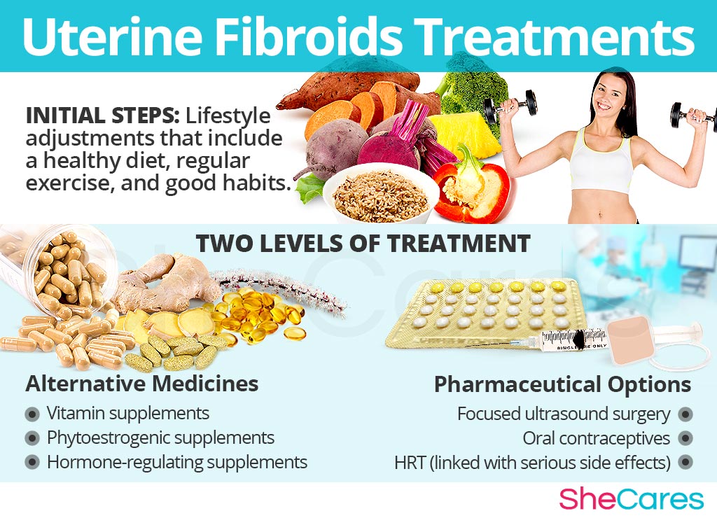 Uterine Fibroids Treatments