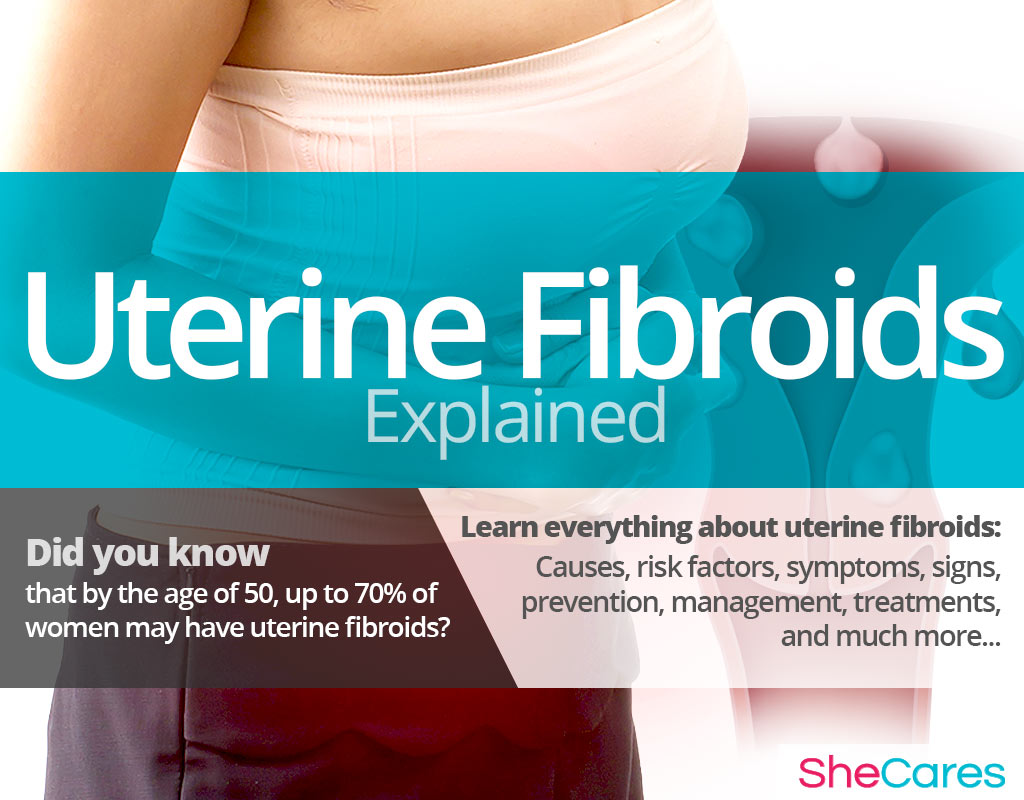 Uterine Fibroids