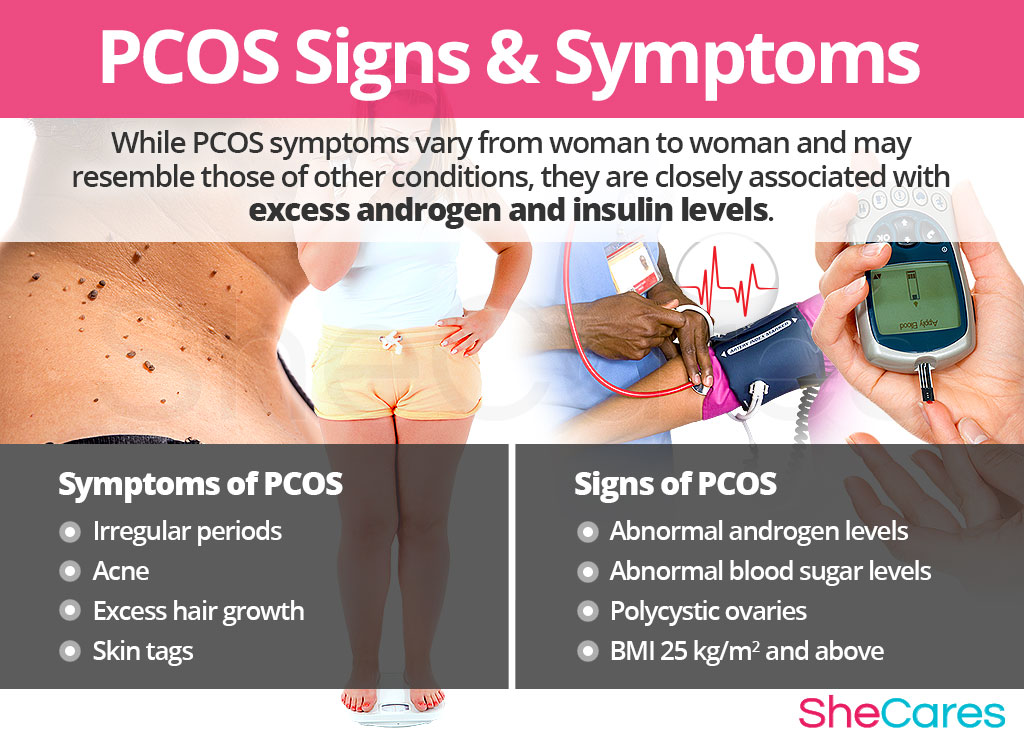 PCOS Polycystic Ovary Syndrome SheCares