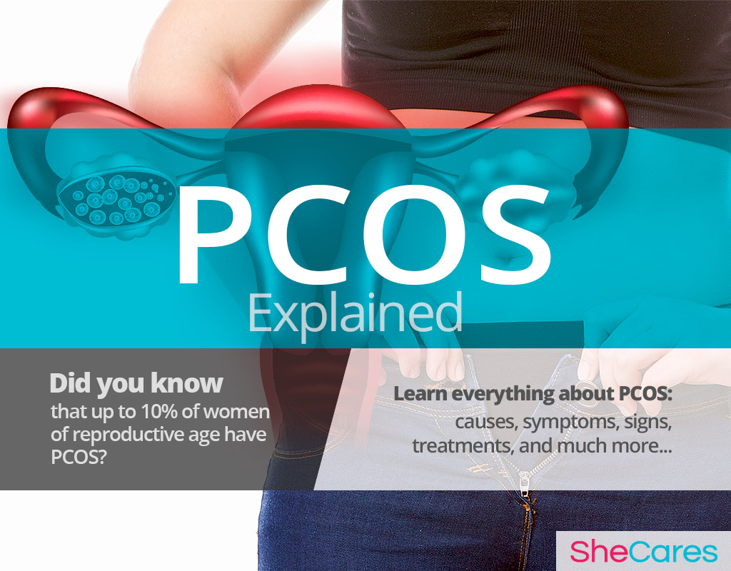  Icd 10 Pcos 99DEGREE