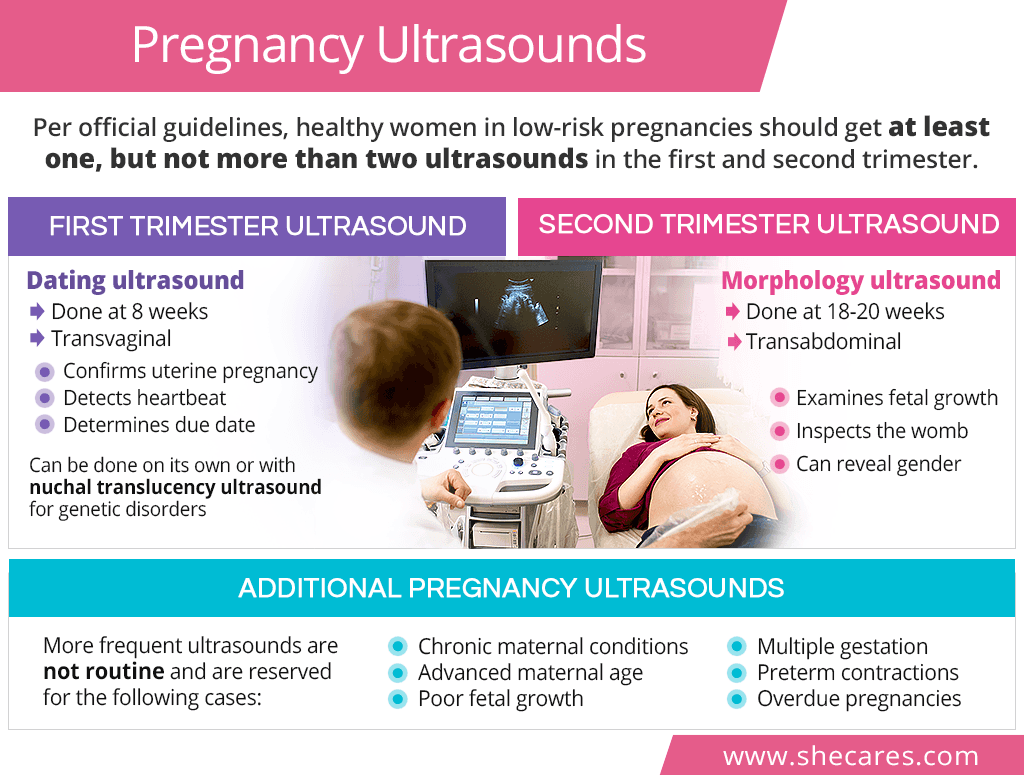 Pregnancy ultrasound