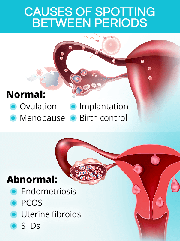 What causes spotting between periods?