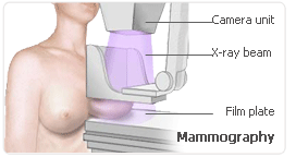 hrt x ray