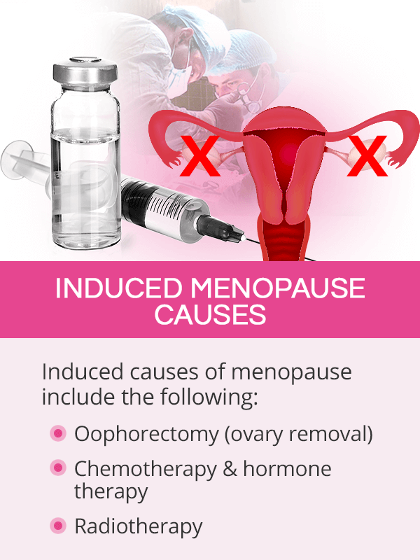 Induced menopause causes