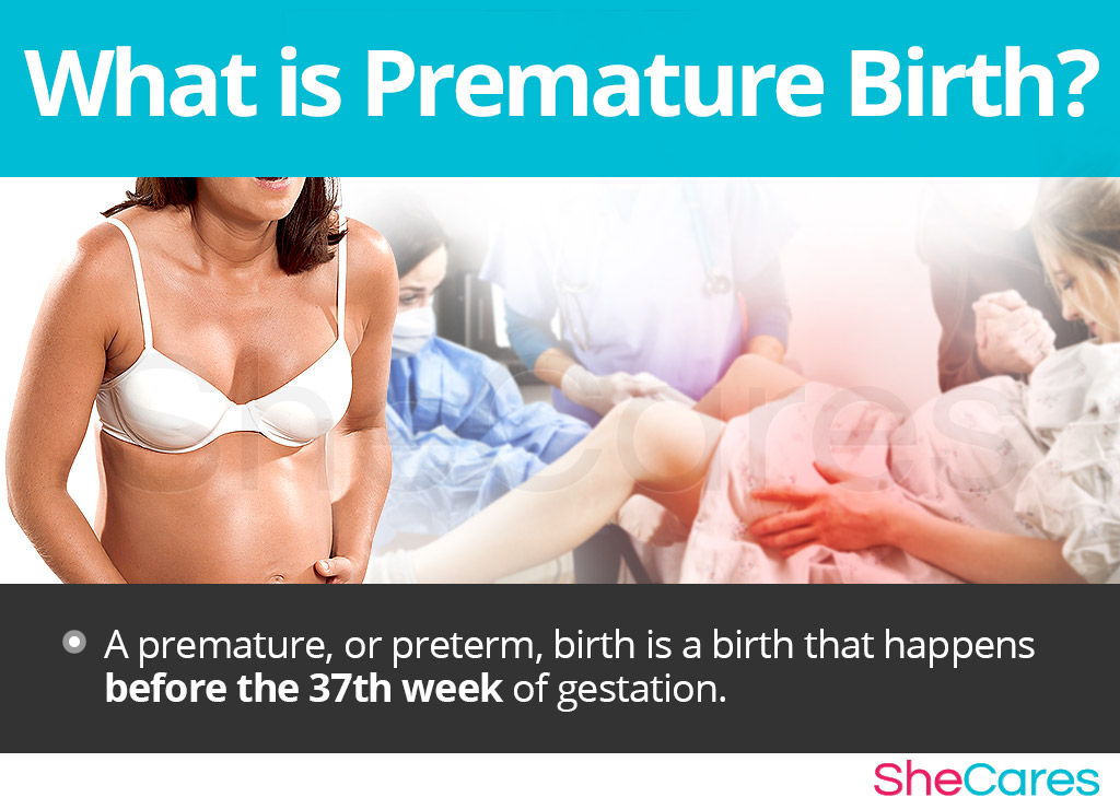 What is Premature Birth?