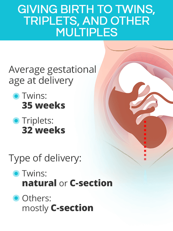 Giving birth to twins, triplets, and other multiples