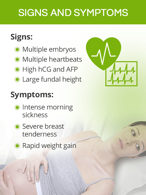 Signs and symptoms of multiple pregnancy