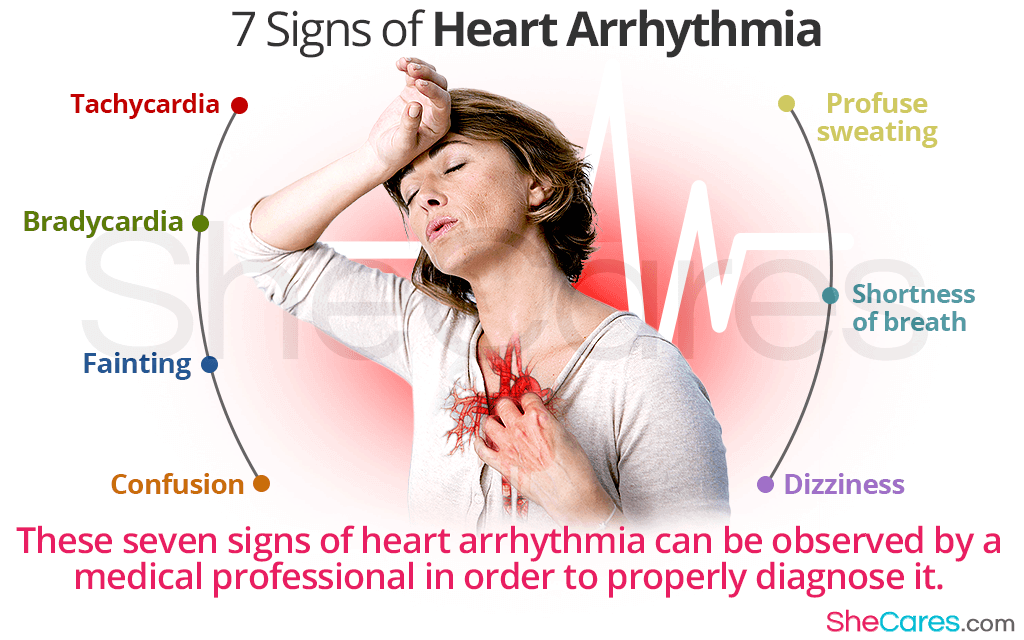 Heart Arrhythmia: 7 Signs of Irregular Heartbeat and More