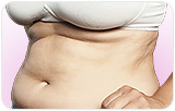 Menstrual cycles can indicate diabetes risk
