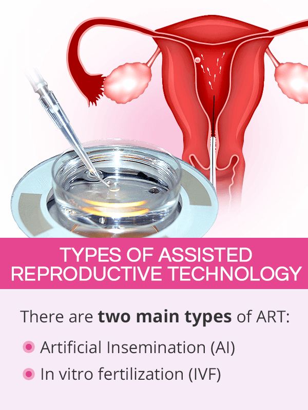 Types of assisted reproductive technology