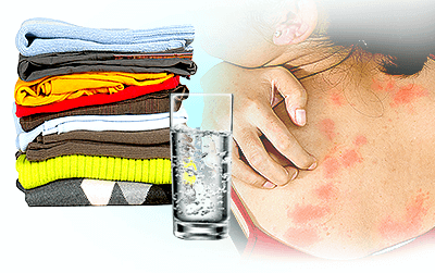 How to Stop Itchy Skin