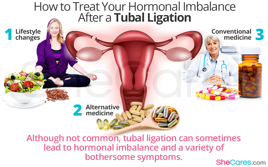 How to Treat Your Hormonal Imbalance After a Tubal Ligation