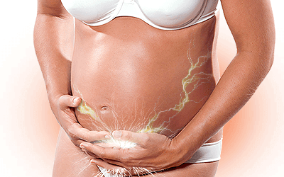 Electric Shock Feeling while Pregnant: What's Happening?