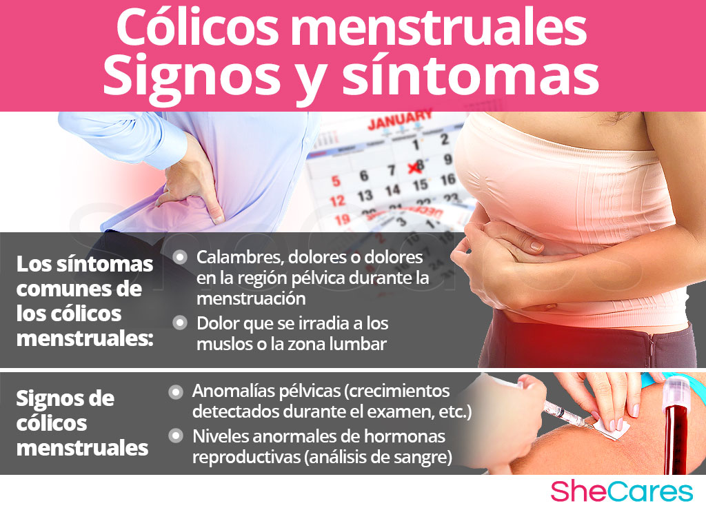 Cólicos menstruales signos y síntomas