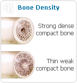 Bone density