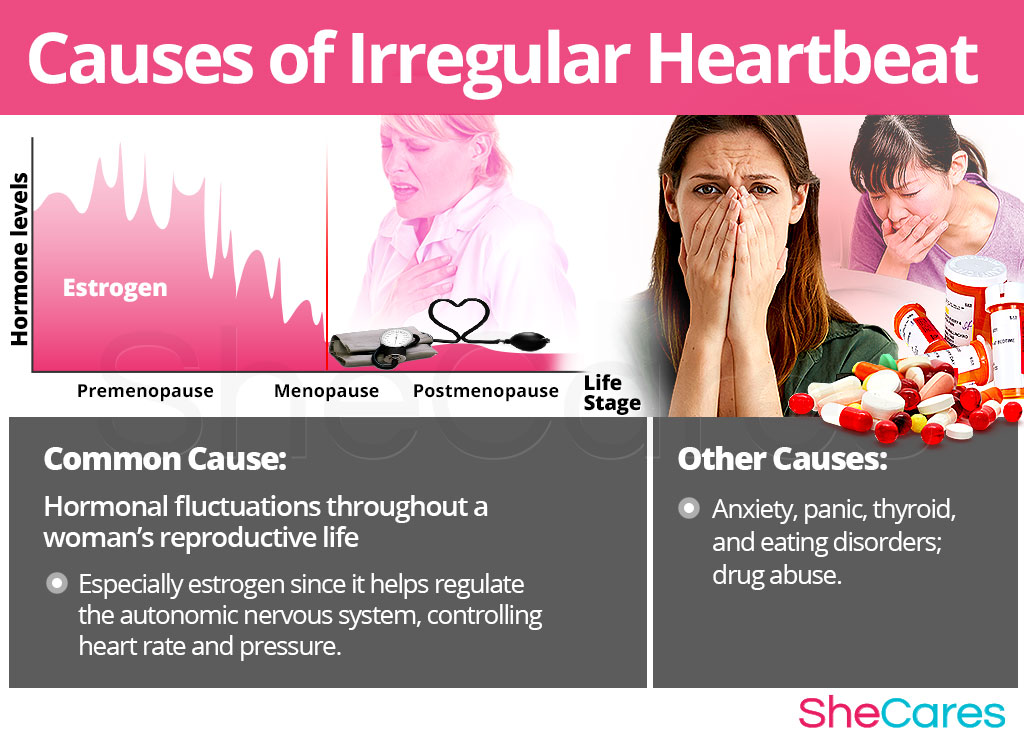 Causes of Irregular Heartbeat