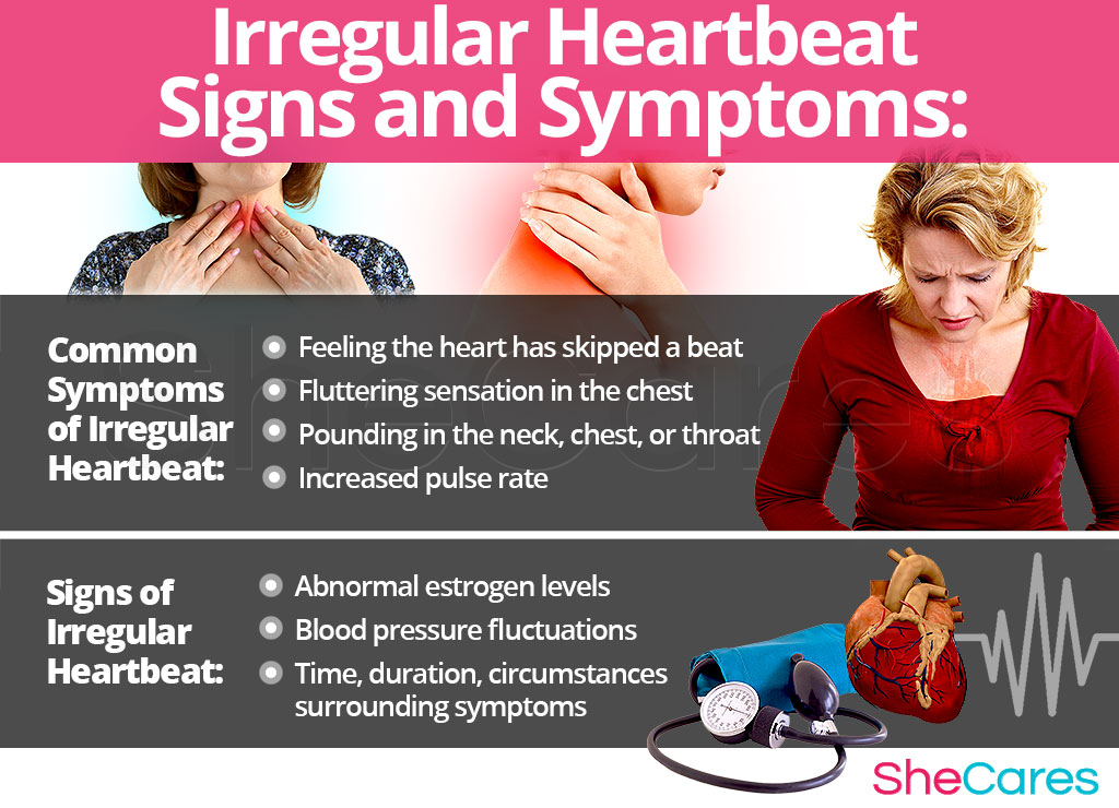 Irregular Heartbeat - Signs and Symptoms