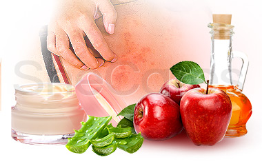 7 Home Remedies for Itchy Skin