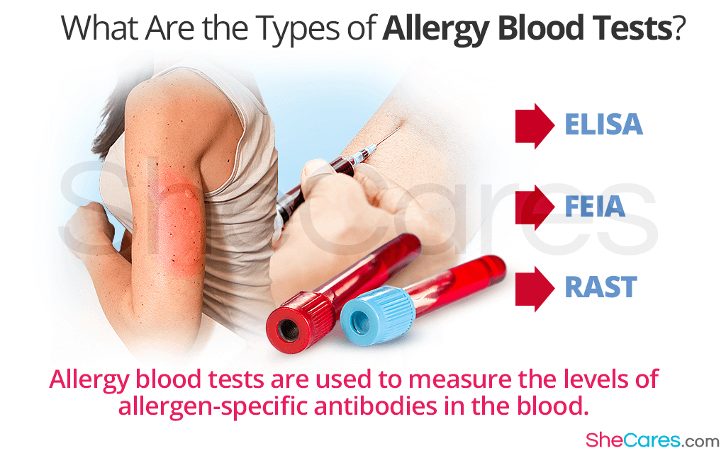 What Are the Types of Allergy Blood Test