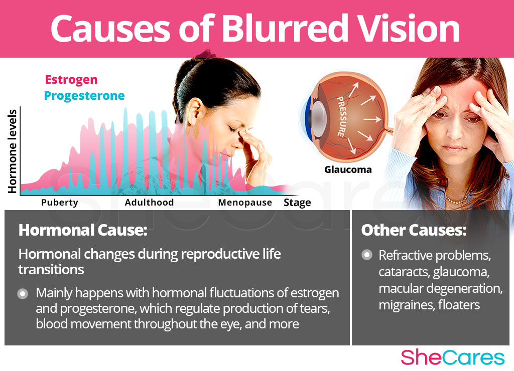 Causes of Blurred Vision