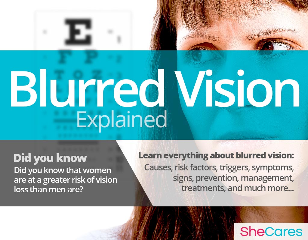 can minoxidil cause blurred vision