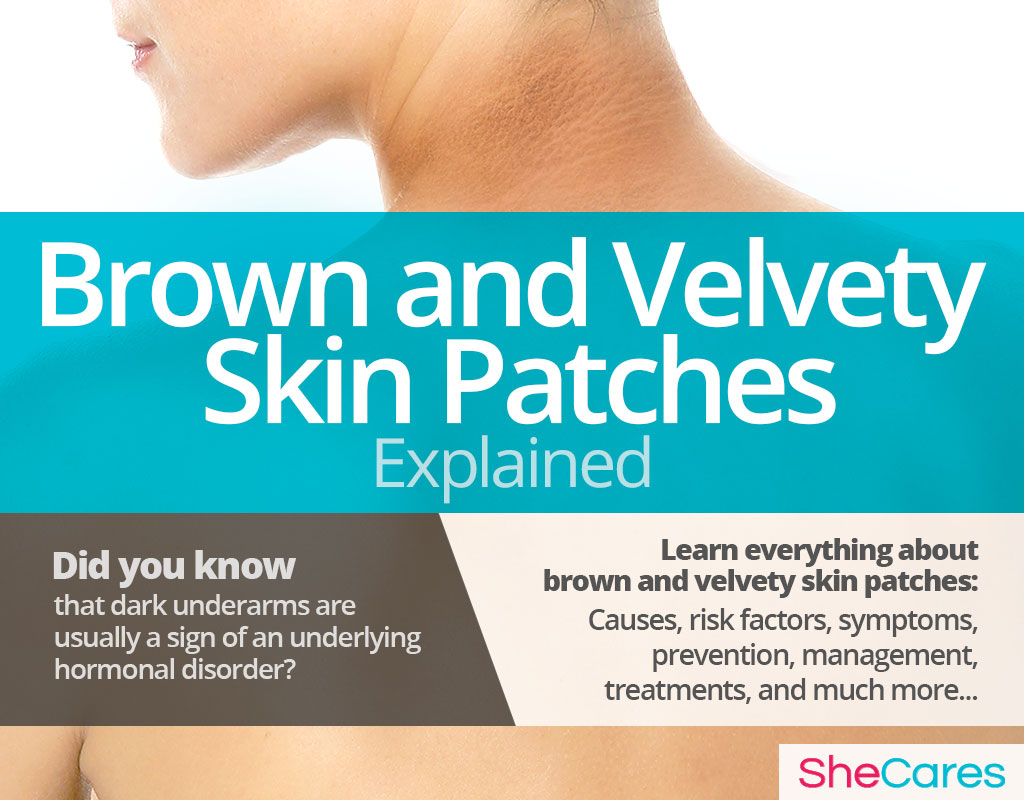 Brown and Velvety Skin Patches