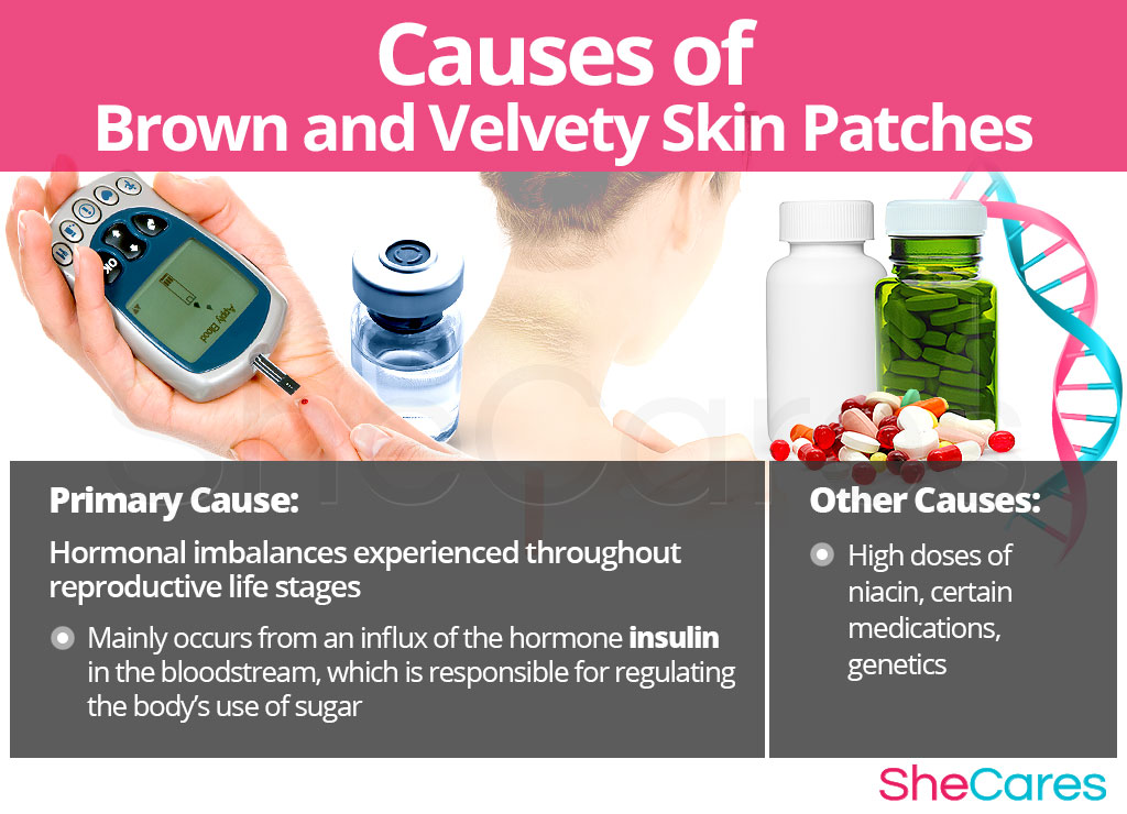 Causes Brown and Velvety Skin Patches