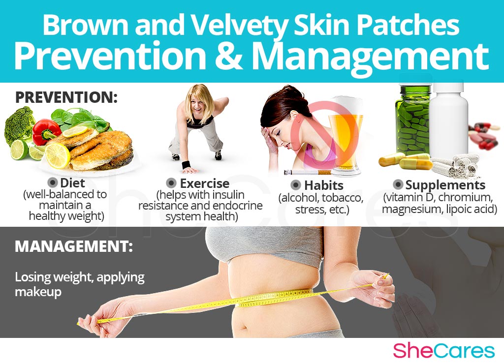 Brown and Velvety Skin Patches - Prevention and Management