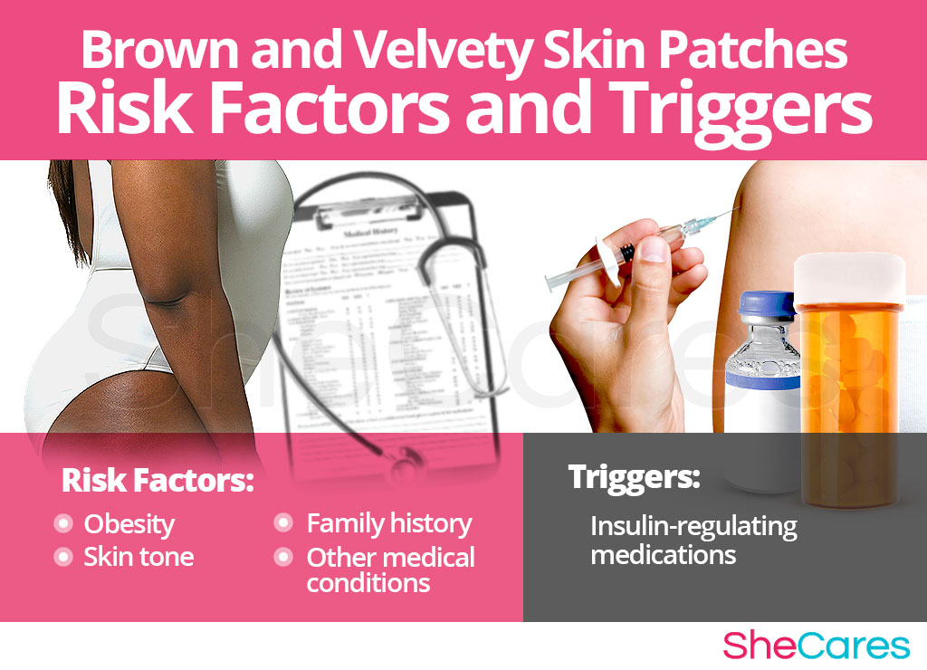 Brown and Velvety Skin Patches - Risk Factors and Triggers