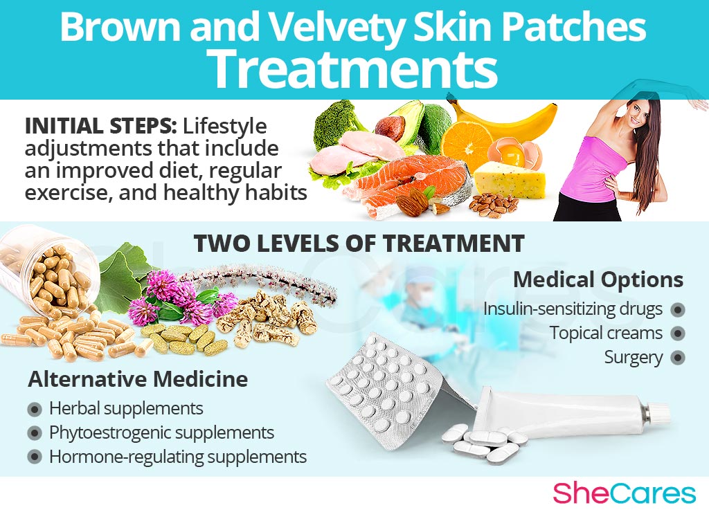 Brown and Velvety Skin Patches Treatments