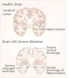 hrt cortex