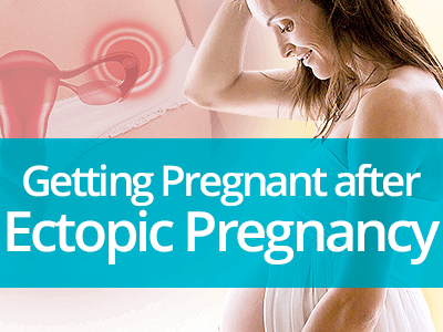 Getting Pregnant after Ectopic Pregnancy