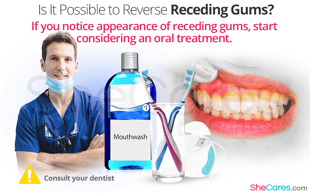 Receding Gums FAQs