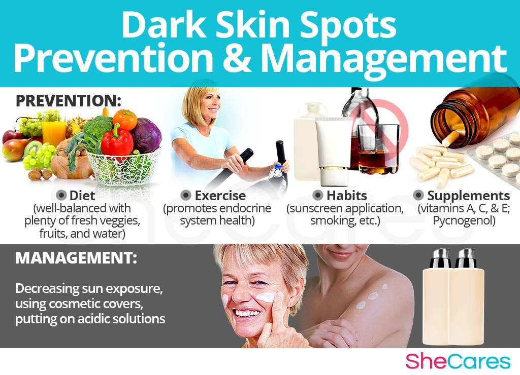 Dark Skin Spots - Prevention and Management