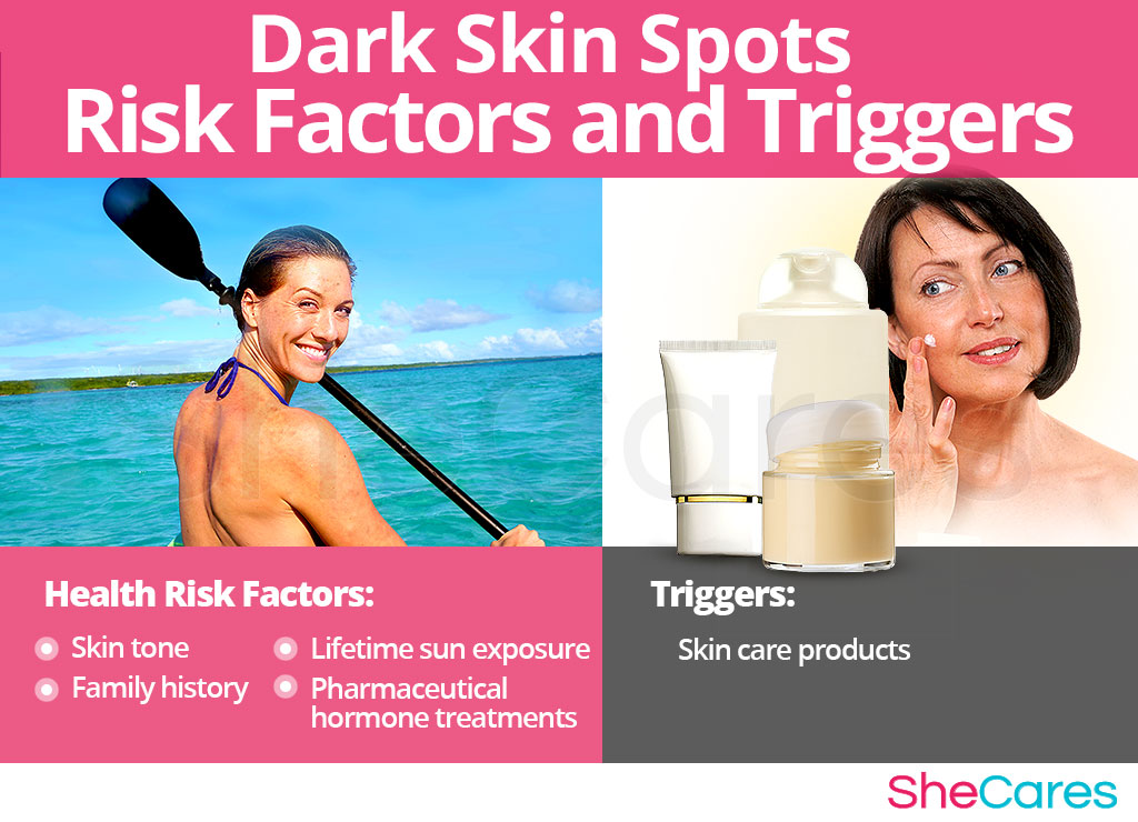 Dark Skin Spots - Risk Factors and Triggers