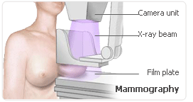 hrt mammography