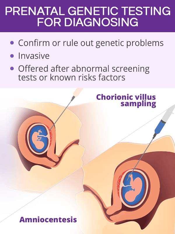 Prenatal genetic testing for diagnosing