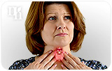 Using Natural Hormones for Thyroid Problems