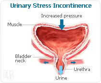 estrogen incontinence