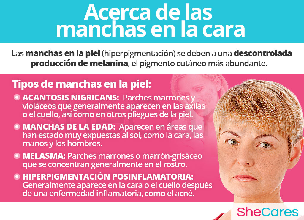 Acerca de las manchas en la cara