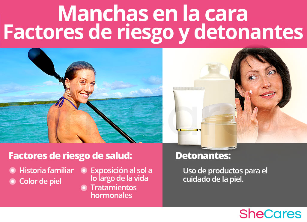 Manchas en la cara: factores de riesgo y desencadenantes