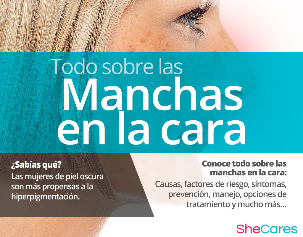 Manchas en la cara