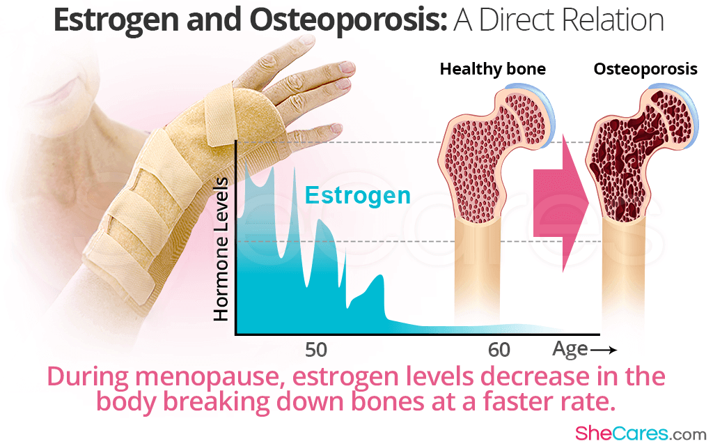 During menopause, estrogen levels decrease in the body breaking down bones at a faster rate.