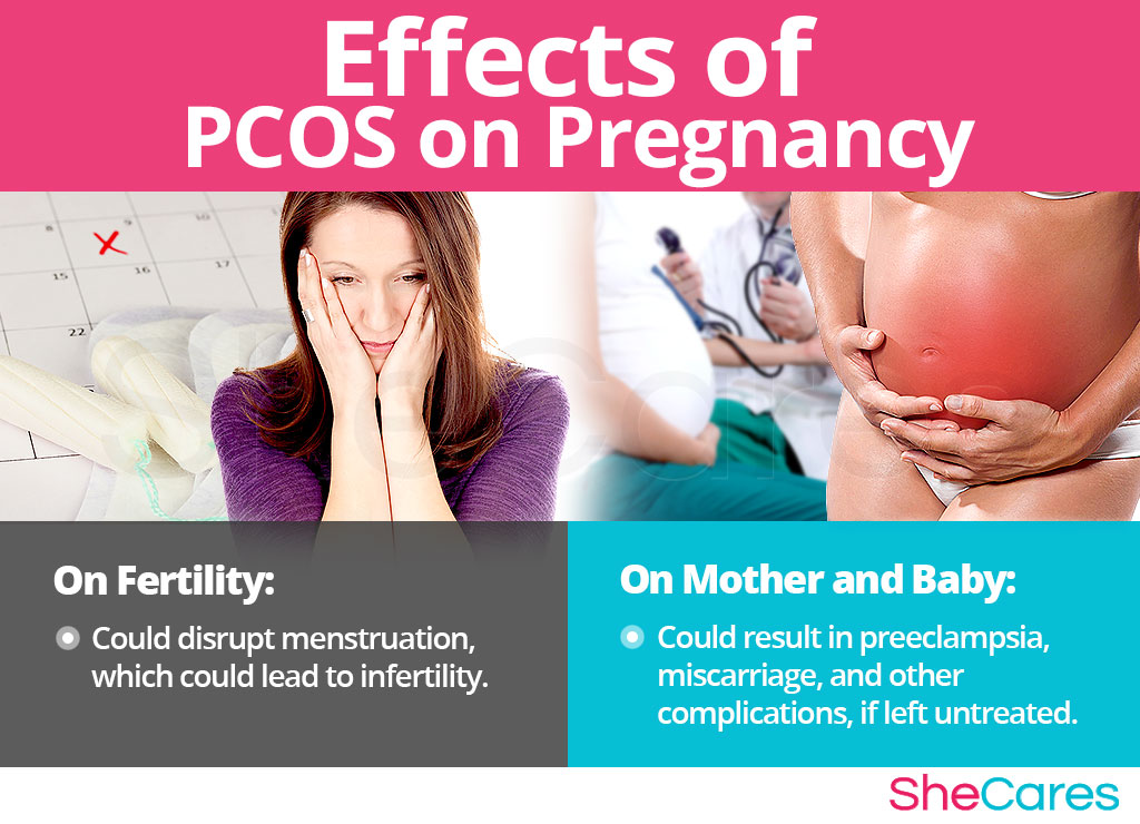 Effects of PCOS on the Mother and Baby.