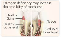 estrogen tooth