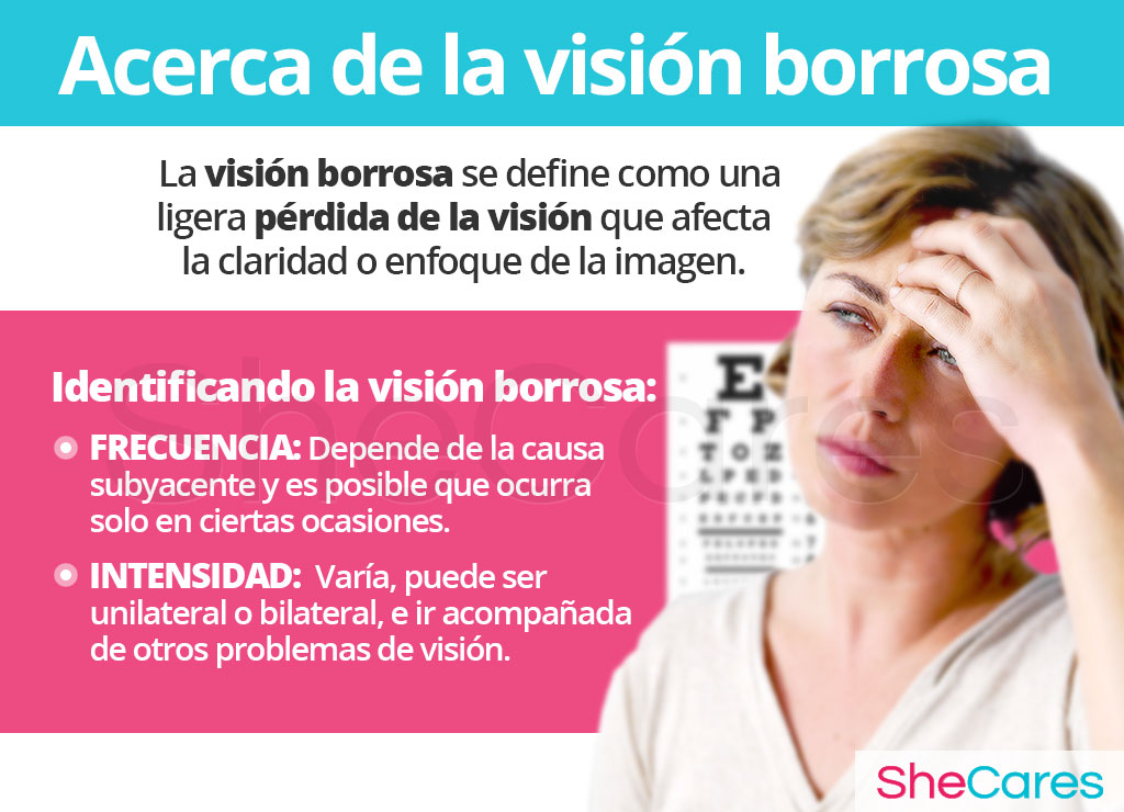 Acerca de la visión borrosa